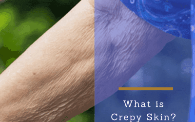 What is Crepy Skin?